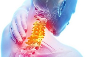 mugurkaula kakla daļas osteohondrozes simptomi